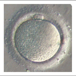 Photographie d'un ovocyte, gamète femelle
