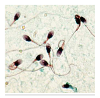 Photographie de spermatozoïdes, gamète mâle