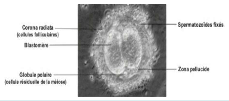 Histologie d'un ovocyte fécondé entouré de sa corona radiata