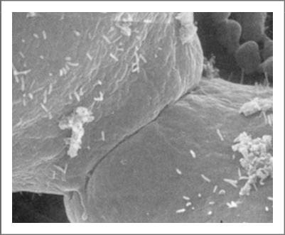 Micrographie de la compaction de la morula vers J4