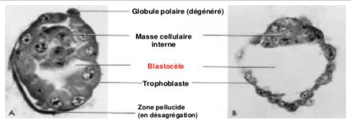 Histologie d'un blastocyste précoce : blastocèle, masse cellulaire interne et trophoblaste