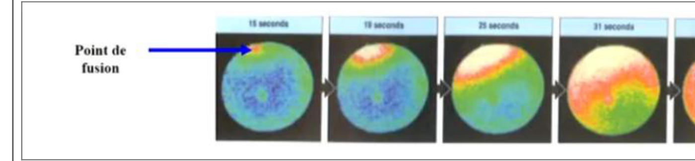 Enregistrement des oscillations calciques lors de l'activation ovocytaire