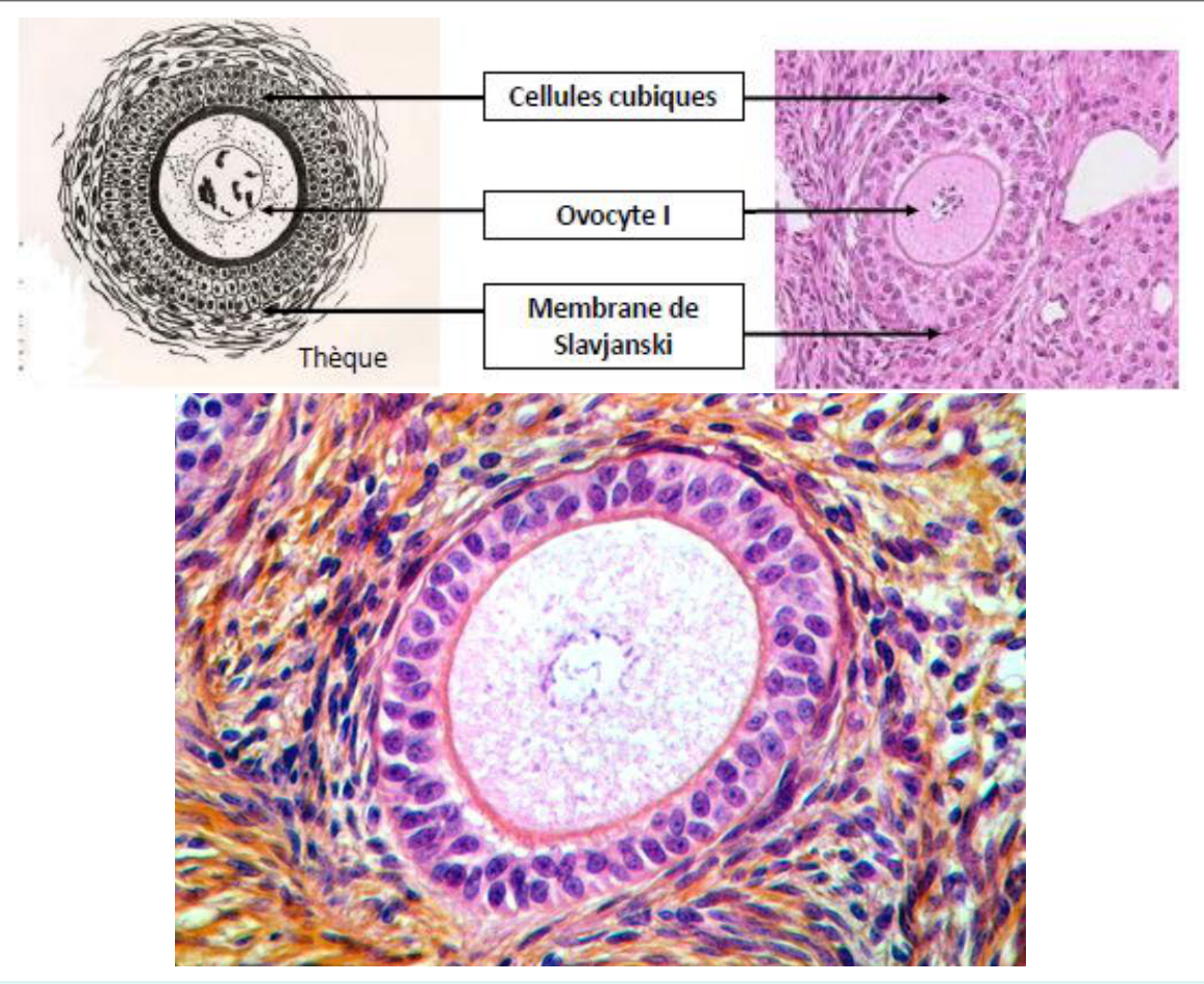 Le follicule secondaire : granulosa pluristratifiée, zone pellucide et thèques