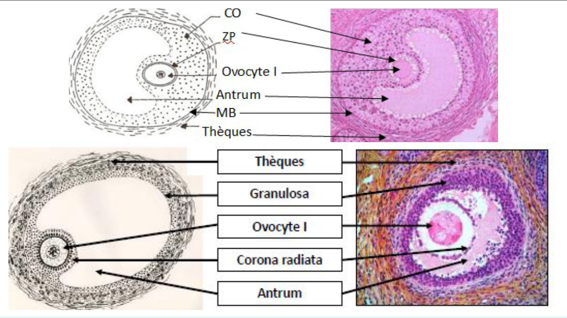Le follicule tertiaire (antral) : antrum, cumulus oophorus, granulosa et thèques