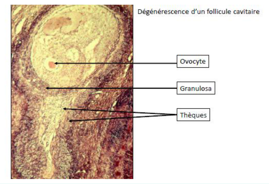 Histologie d'un follicule en atrésie