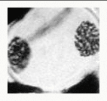 Anaphase de méiose : séparation des chromosomes vers les pôles
