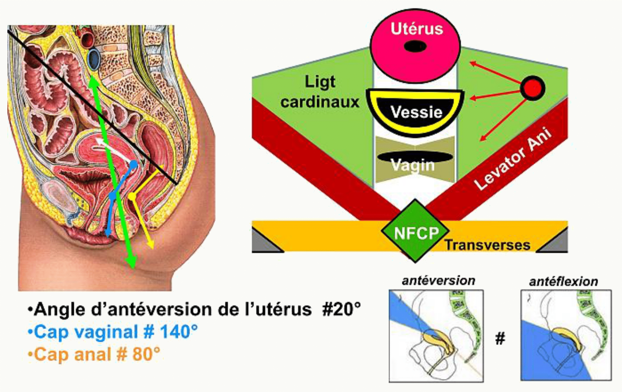 Angle d'antéversion de l'utérus et caps vaginal et anal