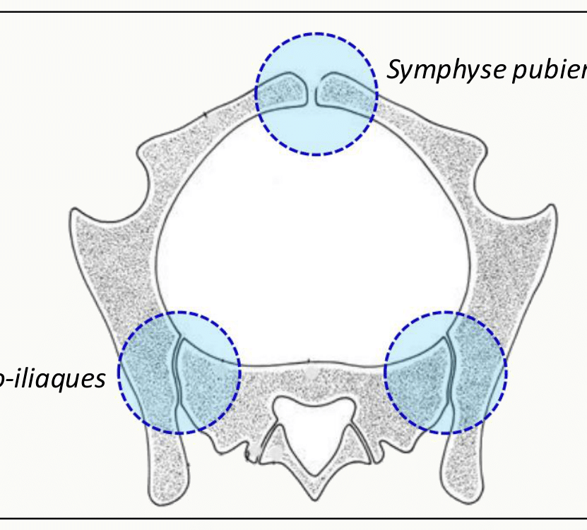 Articulations du pelvis : symphyse pubienne en avant et articulations sacro-iliaques en arrière
