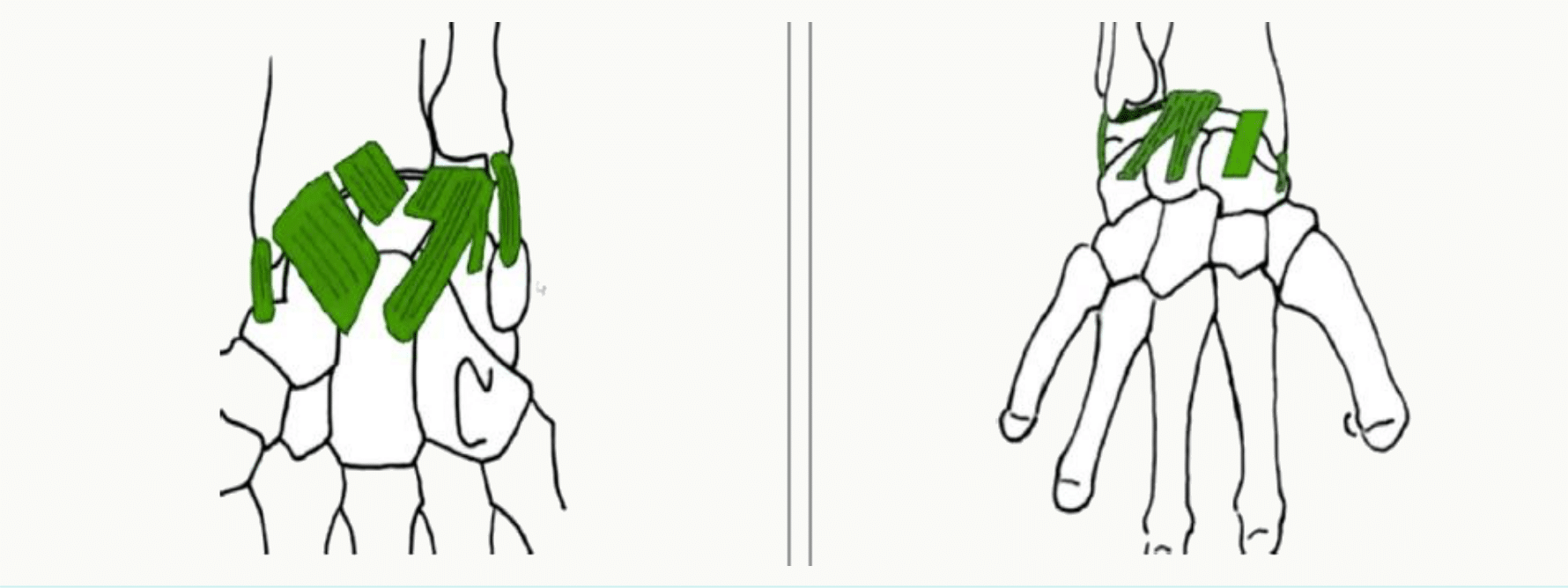 Articulations inter-carpiennes entre les deux rangées et à l'intérieur de chaque rangée