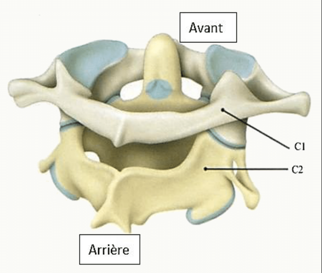 Atlas et axis assemblés formant l'articulation atlanto-axoïdienne