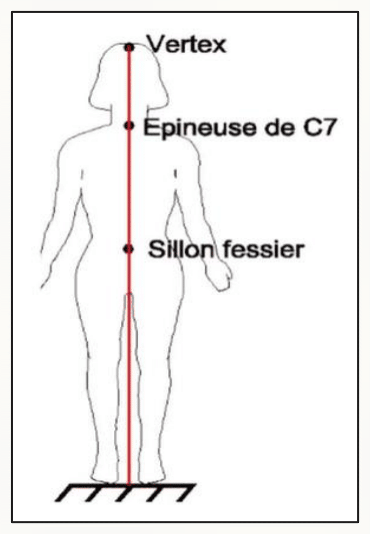 Axe médian du corps passant par le vertex, l'épineuse de C7 et le sillon fessier