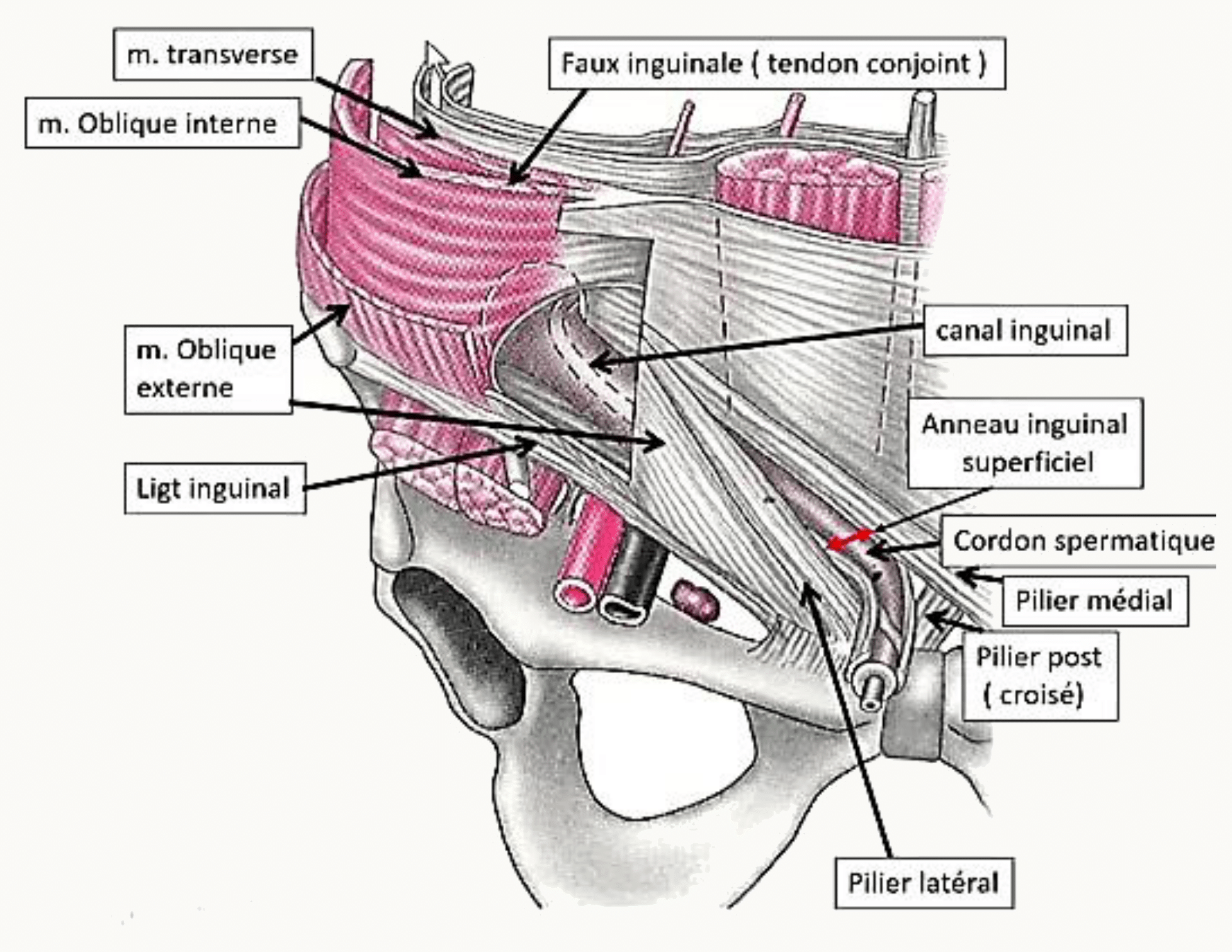 Canal inguinal avec ses piliers, l'anneau inguinal superficiel, le ligament inguinal et le cordon spermatique
