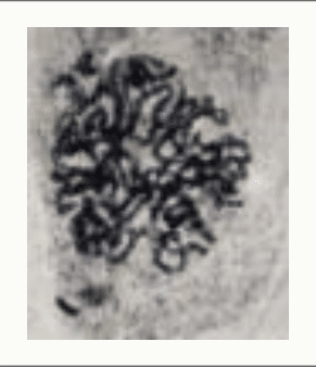 Chromosomes en cours de condensation lors de la prophase, au microscope