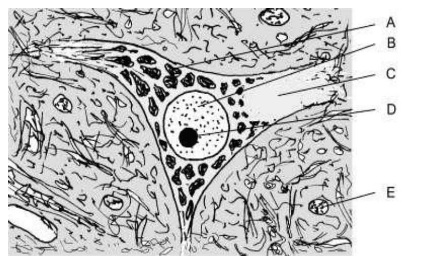 Corps cellulaire d'un neurone avec son noyau nucléolé et ses corps de Nissl