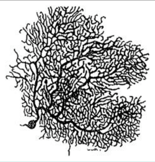 Neurone multipolaire et son arborisation dendritique (imprégnation de Golgi)