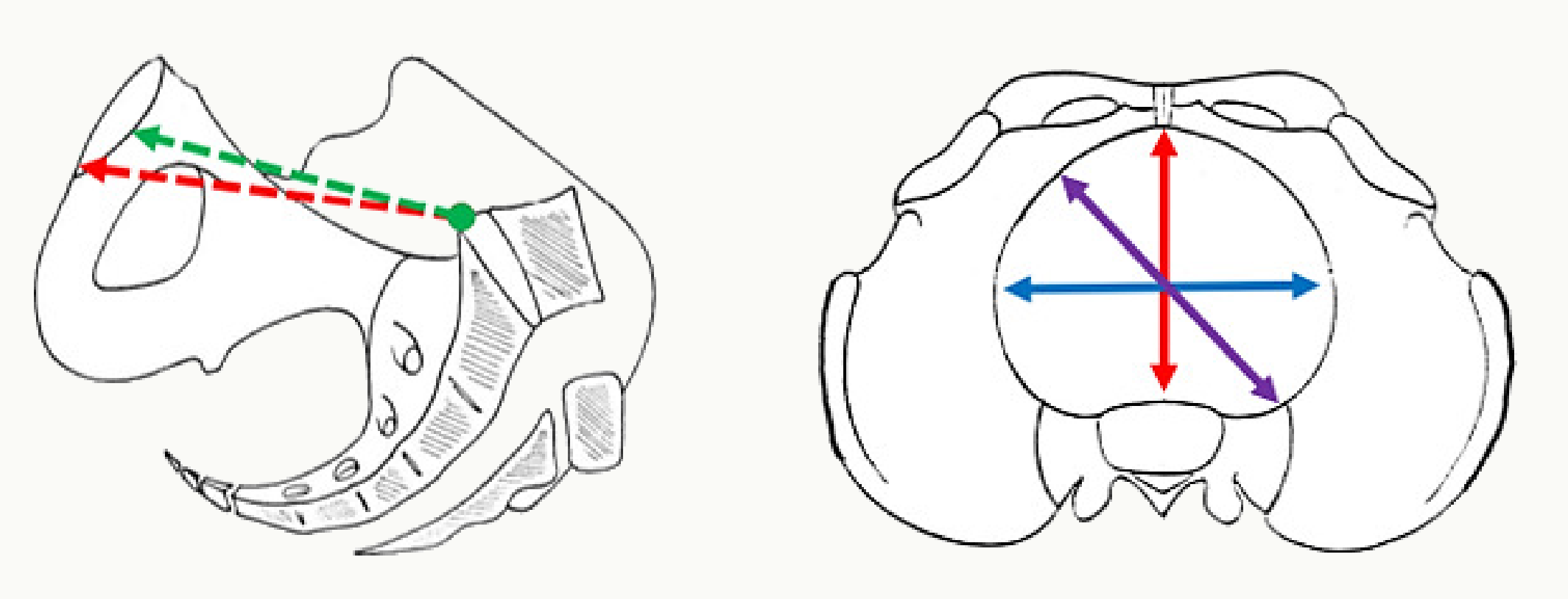 Diamètres transverse, oblique et antéro-postérieur du détroit supérieur