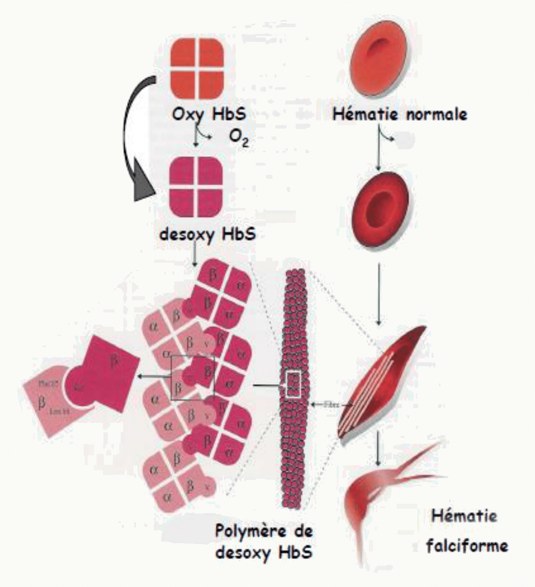 Désoxygénation de l'hémoglobine S, polymérisation en fibres et déformation de l'hématie en faucille