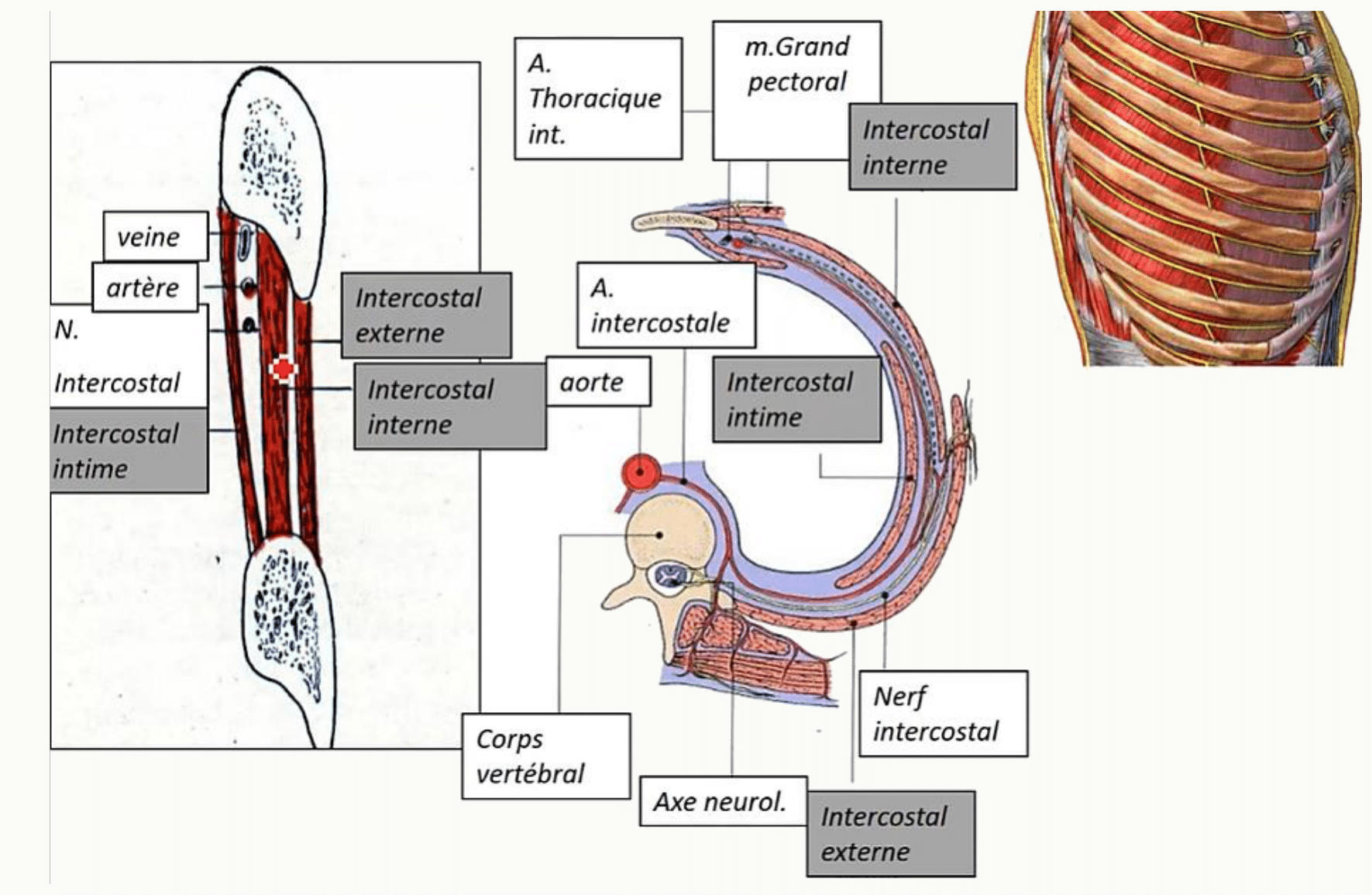 Espace intercostal avec ses trois muscles intercostaux et son paquet vasculo-nerveux sous le bord inférieur de la côte
