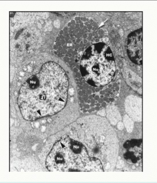 Euchromatine et hétérochromatine dans plusieurs noyaux au microscope électronique