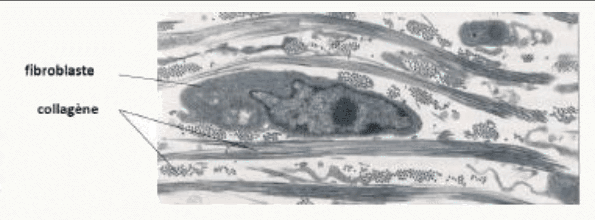 Fibroblaste entouré de fibres de collagène au microscope électronique