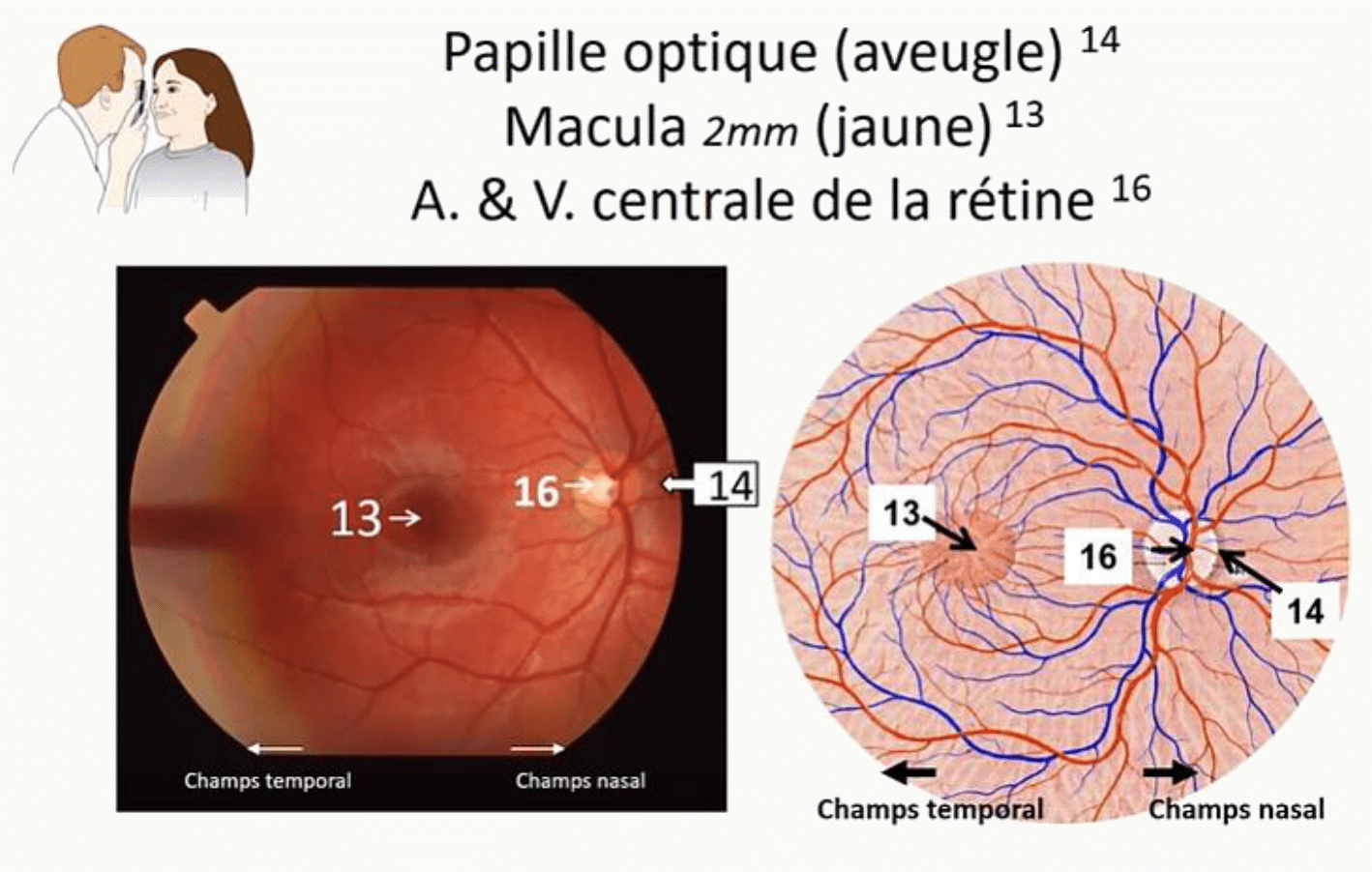Fond d'œil avec la papille optique, la macula et les vaisseaux centraux de la rétine