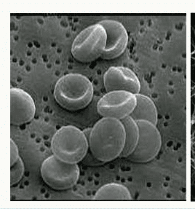 Globules rouges en microscopie électronique à balayage, avec leur forme de disque biconcave