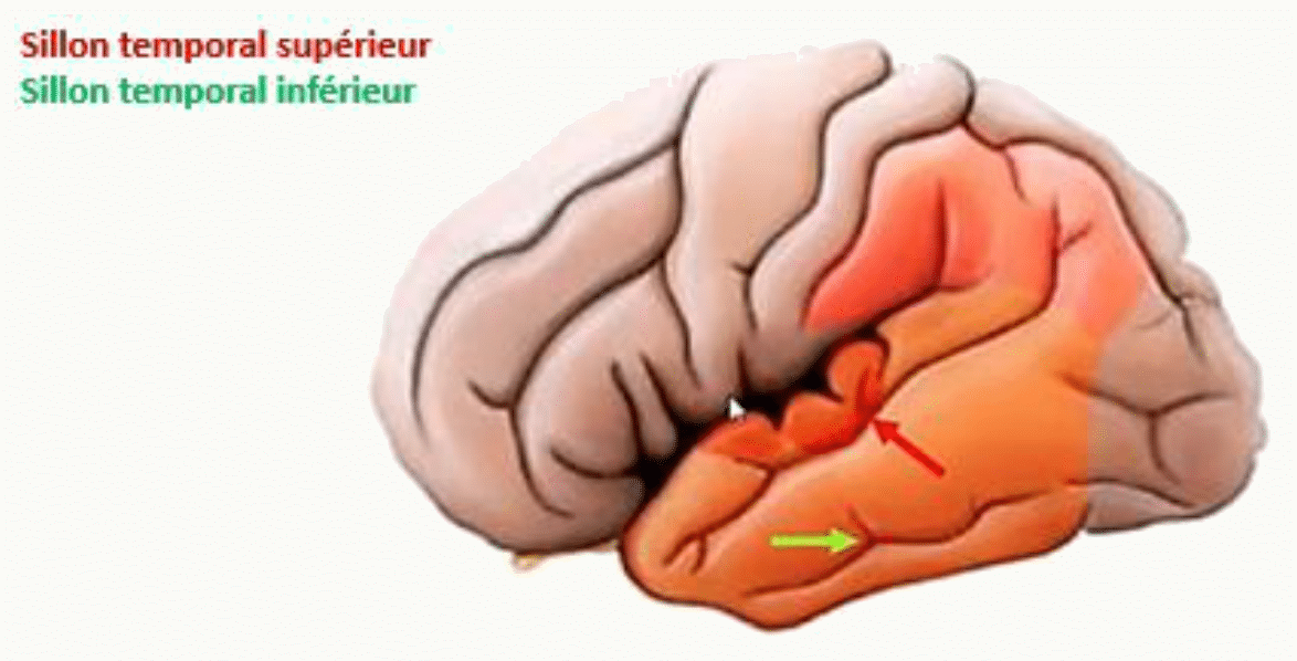 Gyrus temporaux supérieur, moyen et inférieur du lobe temporal