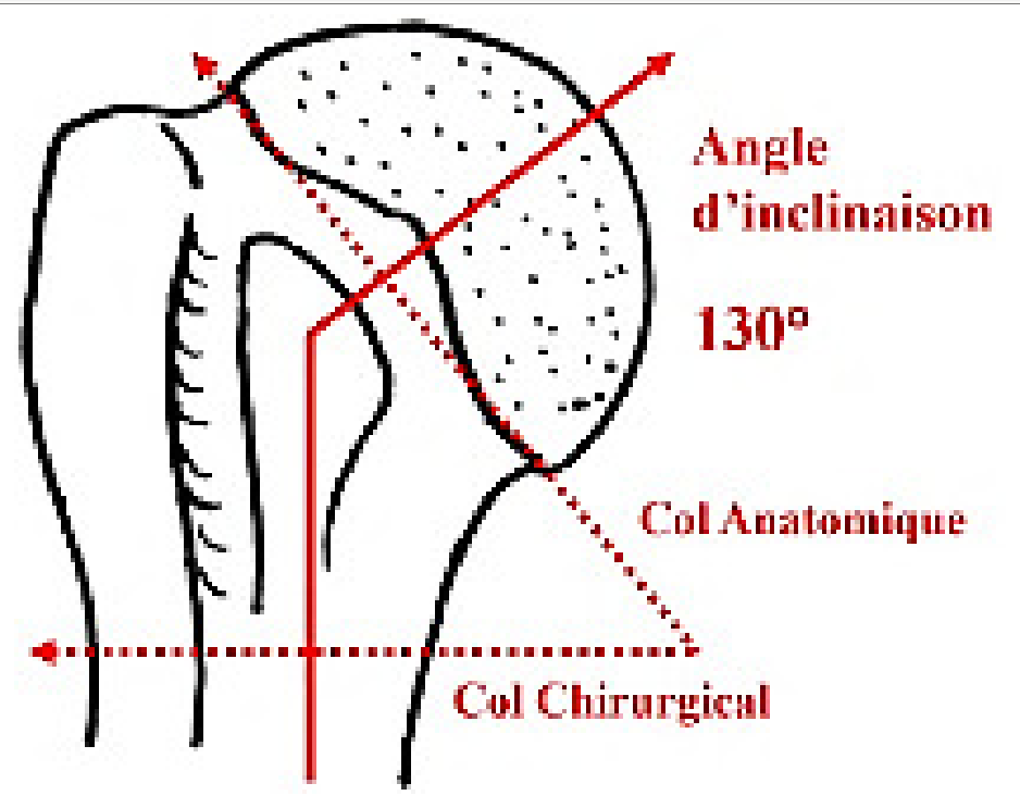 Extrémité proximale de l'humérus : tête, col anatomique, col chirurgical et angle d'inclinaison de 130 degrés