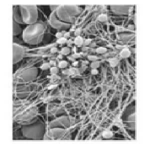 Exemples d'images obtenues au microscope électronique à balayage (MEB) : surfaces cellulaires observées en relief