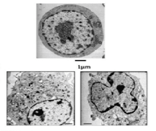 Exemples d'images obtenues au microscope électronique à transmission (MET) : ultrastructure interne des cellules