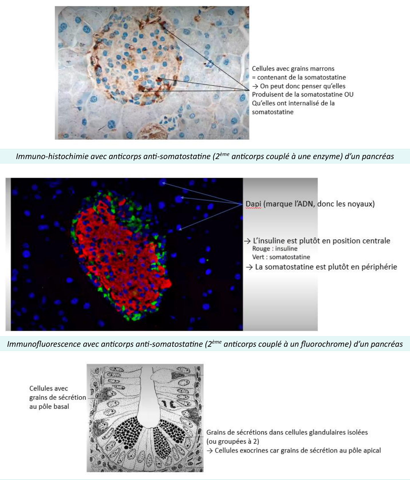 Îlot pancréatique révélé par immunohistochimie et immunofluorescence (somatostatine, insuline)