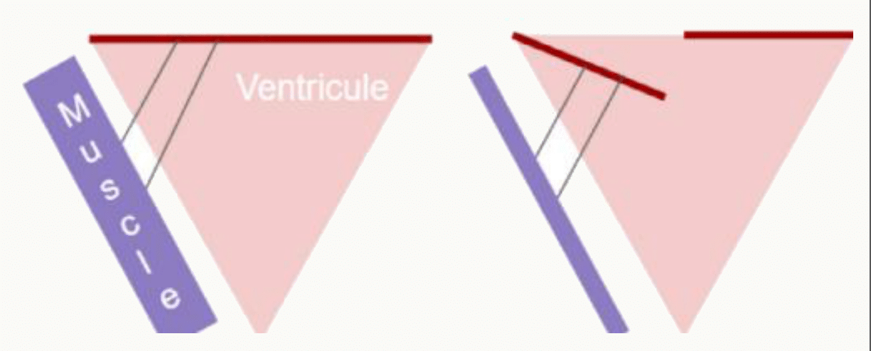 Insertion des valves sur le squelette fibreux entre atriums et ventricules