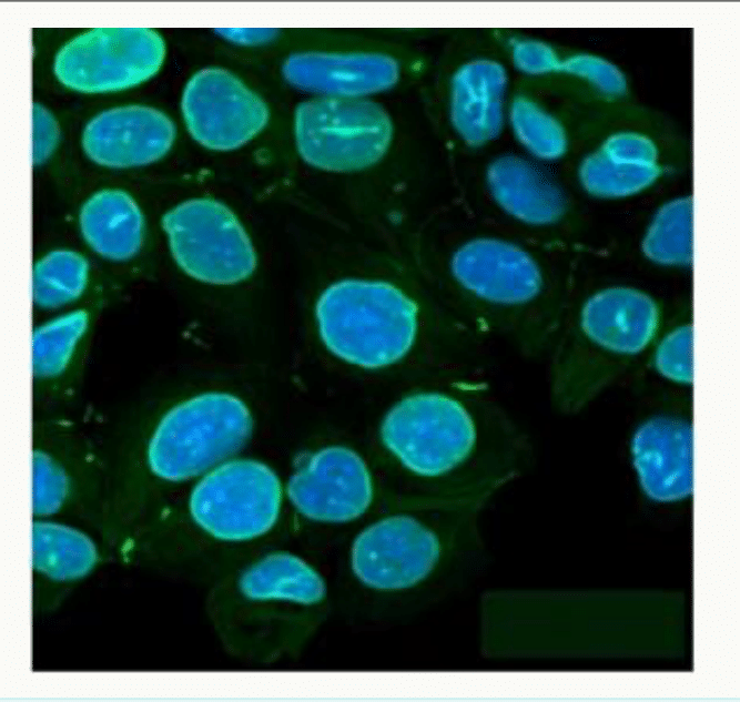 Lamines nucléaires révélées par immunofluorescence, dessinant le contour des noyaux