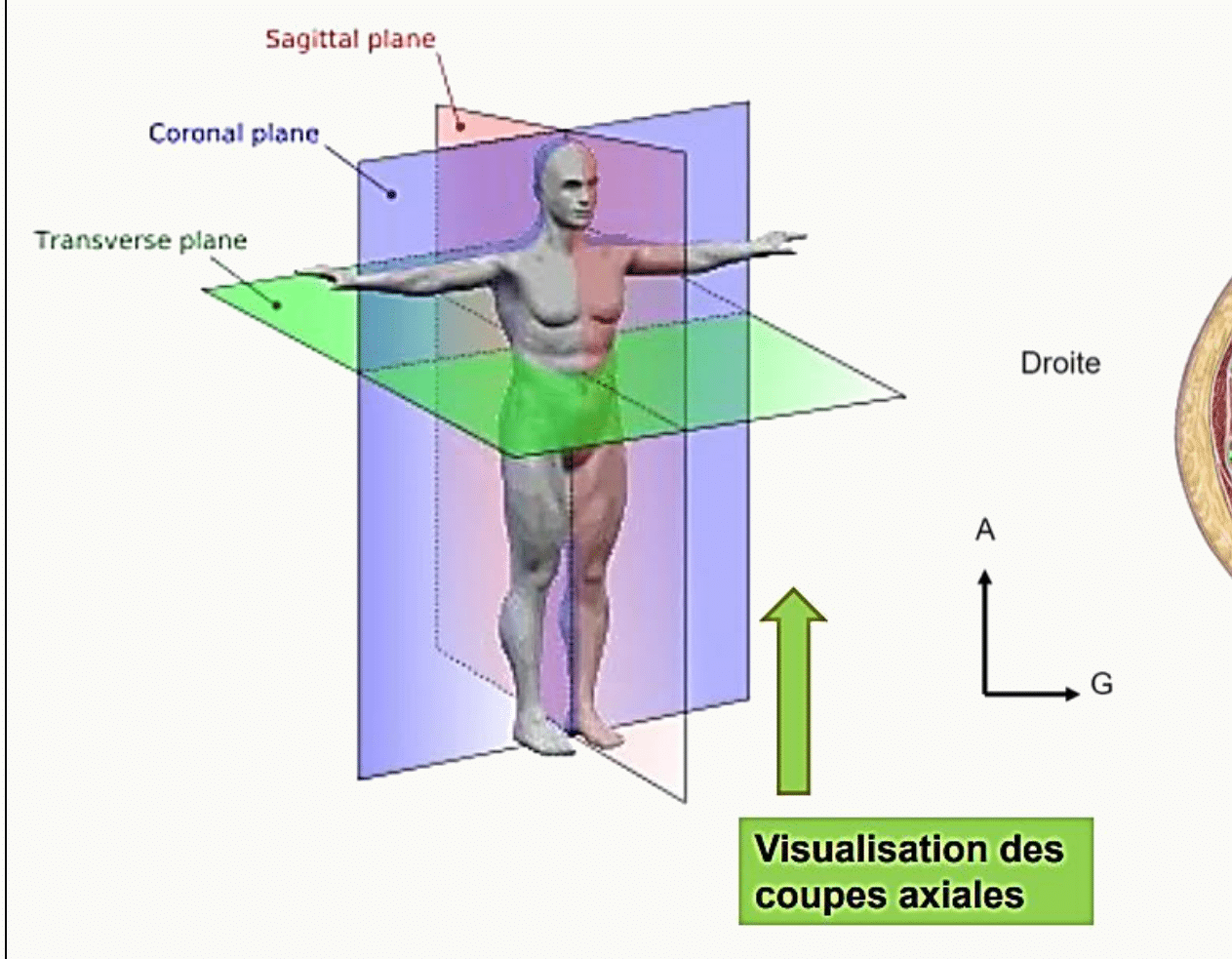 Les trois plans de référence, sagittal, frontal et axial, représentés en volume autour du corps