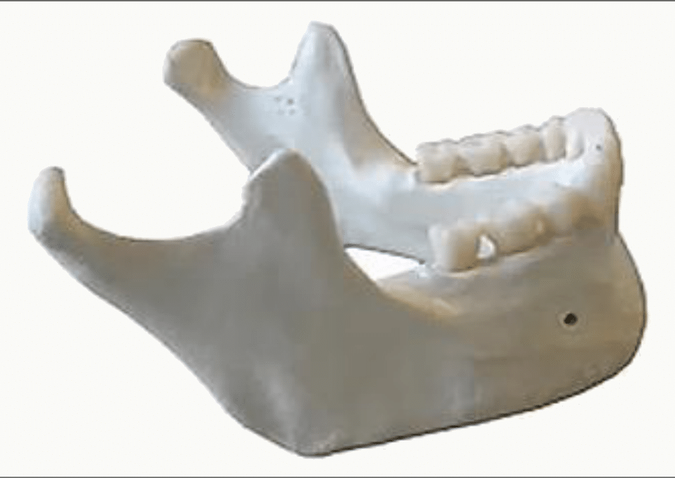 Mandibule en vue oblique