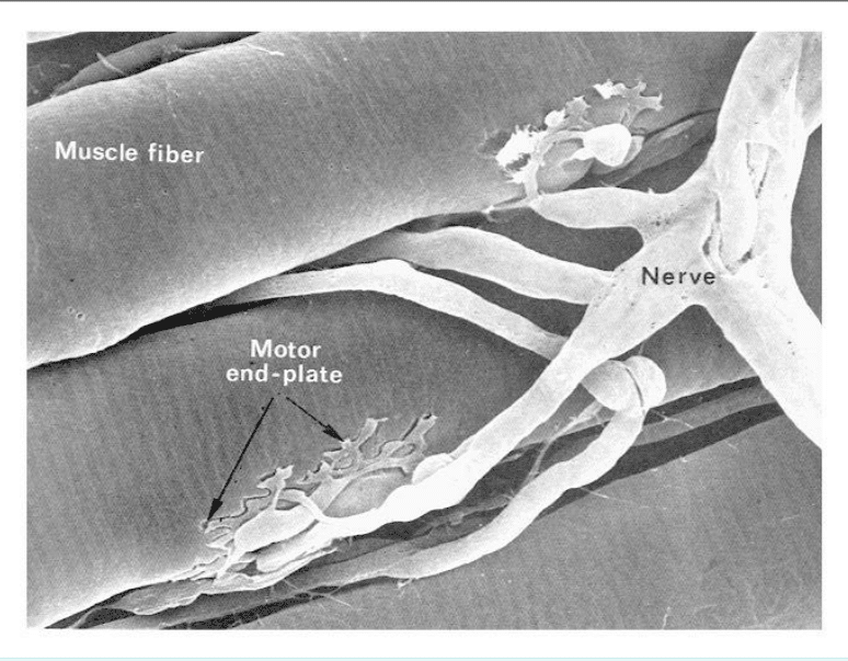 Fibre musculaire innervée par un nerf au niveau de la plaque motrice, en MEB
