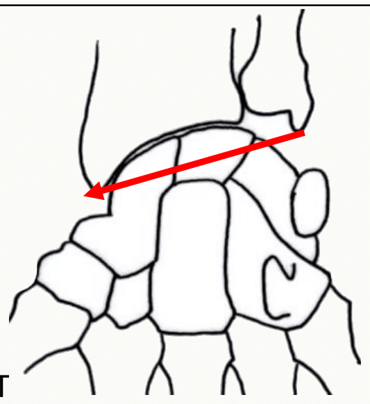 Membrane interosseuse tendue entre les bords interosseux du radius et de l'ulna