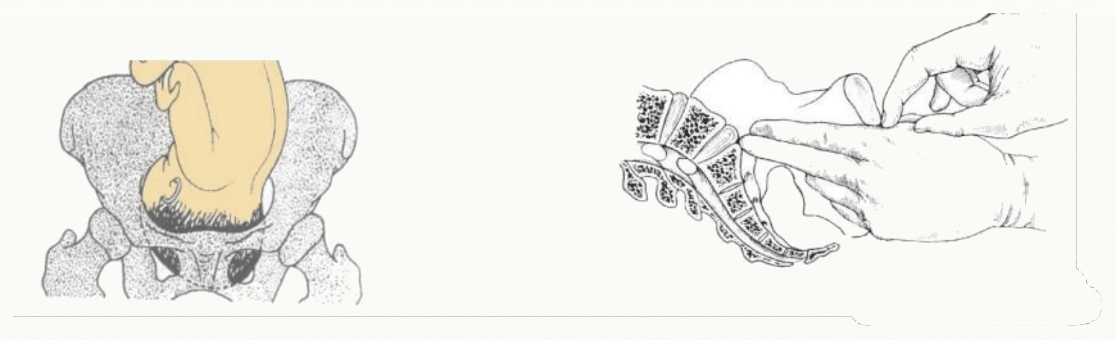 Mesure clinique du diamètre promonto-sous-pubien au toucher vaginal