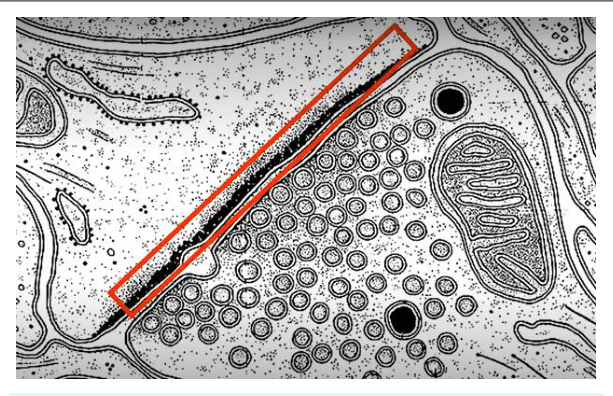 Bouton terminal synaptique et ses vésicules au microscope électronique