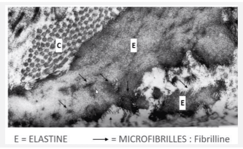 Élastine et microfibrilles de fibrilline au microscope électronique