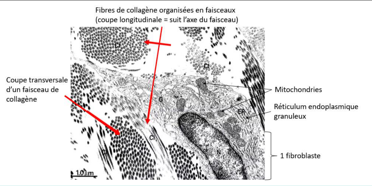 Fibres de collagène et fibroblaste au microscope électronique à transmission