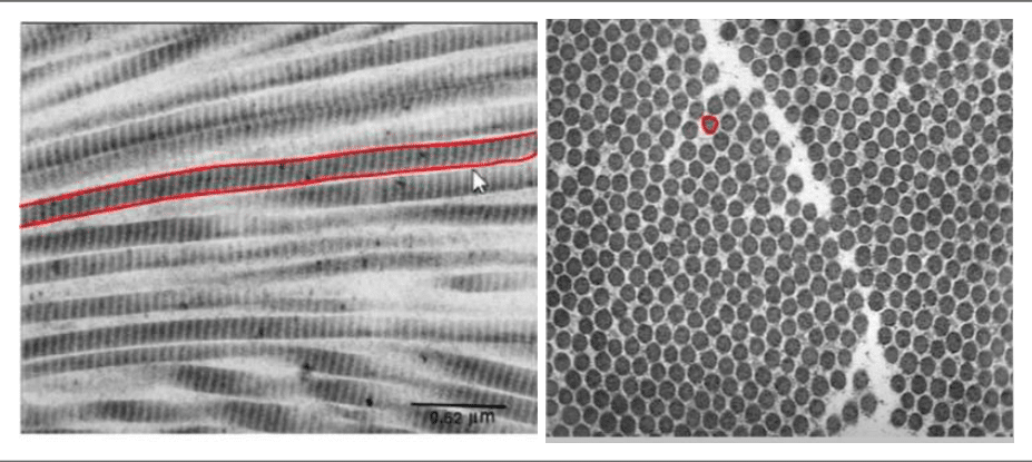 Fibrilles de collagène et leur striation périodique au microscope électronique