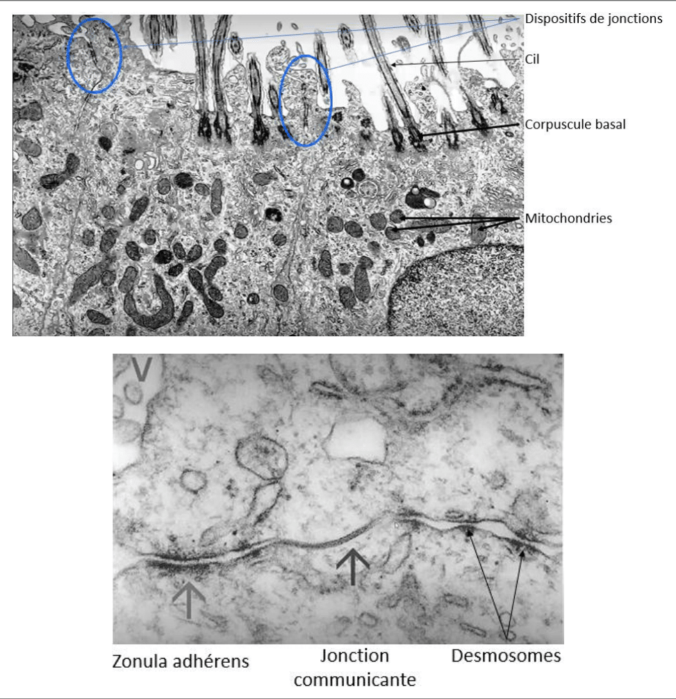 Jonctions intercellulaires de l'épithélium épendymaire au microscope électronique