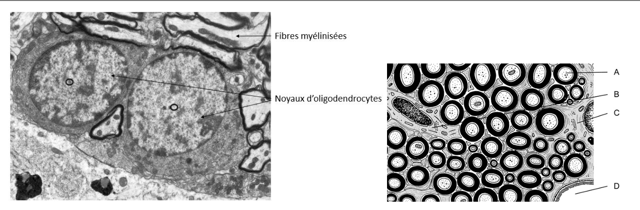 Oligodendrocyte et fibres myélinisées au microscope électronique
