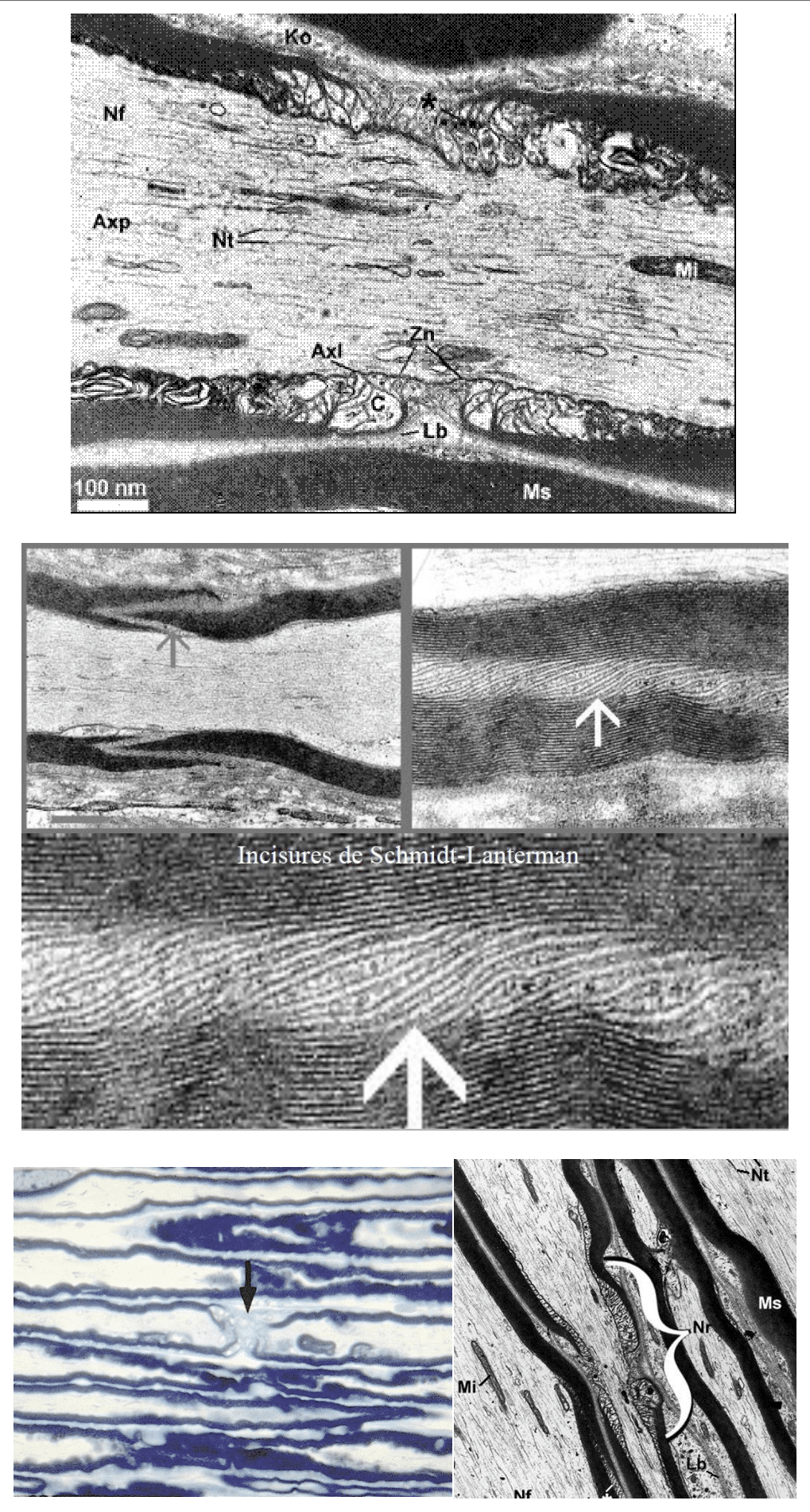 Incisures de Schmidt-Lanterman dans la gaine de myéline, au microscope électronique