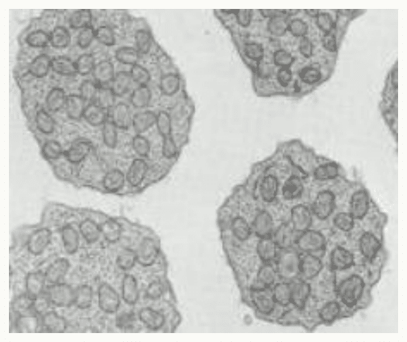 Nombreuses mitochondries observées en coupe au microscope électronique