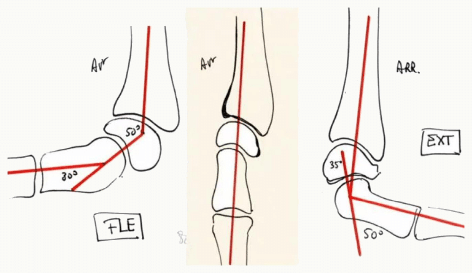 Mouvements du poignet : flexion, extension, inclinaisons radiale et ulnaire, avec leurs amplitudes