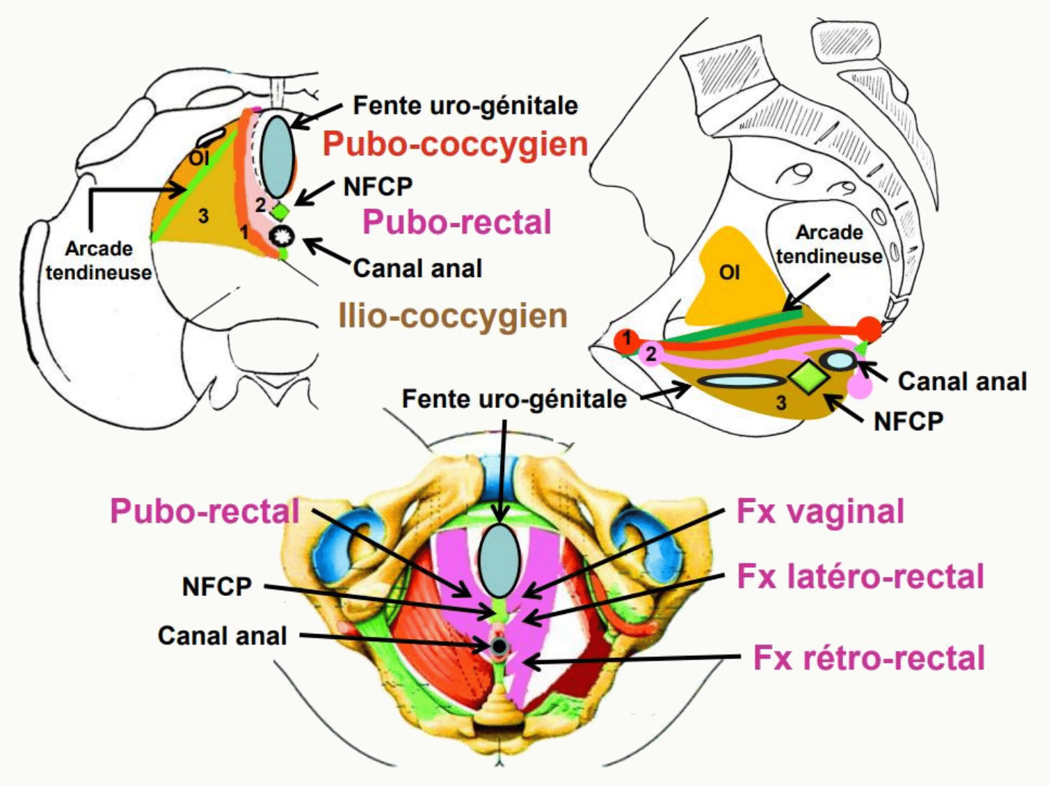 Muscle élévateur de l'anus, ses faisceaux pubo-rectal, pubo-coccygien et ilio-coccygien, et la fente uro-génitale