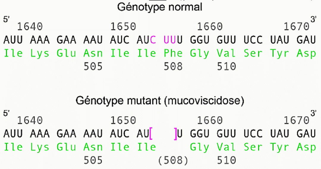 Mutation ΔF508 de la mucoviscidose comparée au génotype normal sur la séquence du gène CFTR