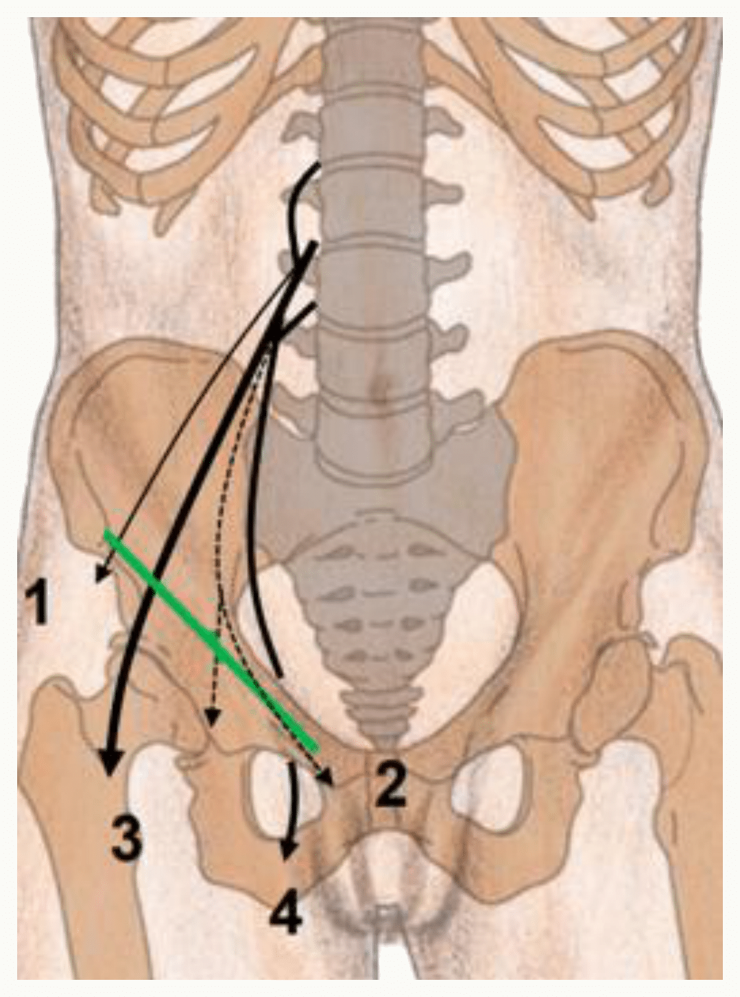 Nerfs du plexus lombal et leur trajet dans le pelvis